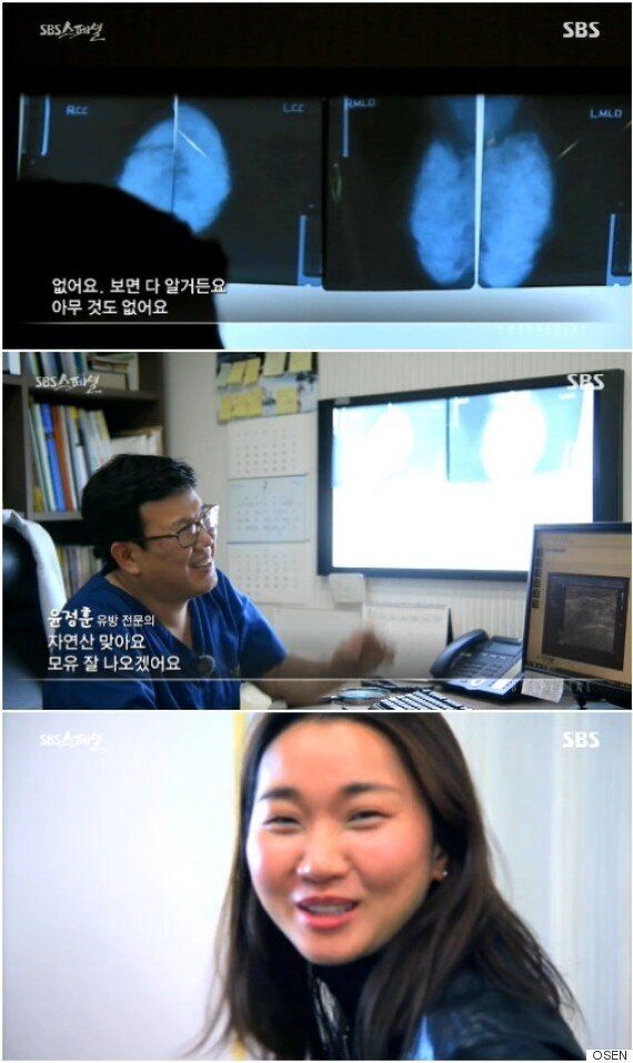 SBS스페셜' 의사 장윤주 가슴, 자연산 맞다 논란 종식