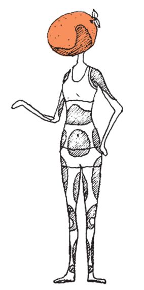 머리부터 발바닥까지, 부위마다 다른 셀룰라이트