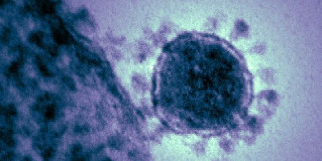 Colorized transmission electron micrograph of the Middle East respiratory syndrome coronavirus. Credit: NIAID