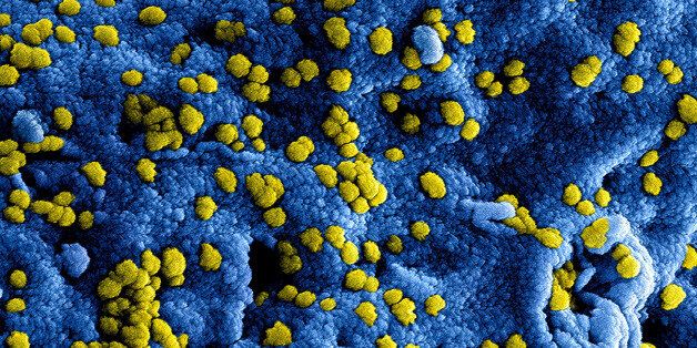 Colorized scanning electron micrograph of Middle Eastern Respiratory Syndrome virus particles attached to the surface of an infected VERO E6 cell. Credit NIAID
