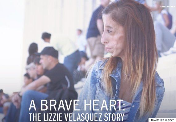 '세상에서 가장 못생긴 여자' 리지 벨라스케스, 괴롭힘에 맞서라고 말하다(동영상)