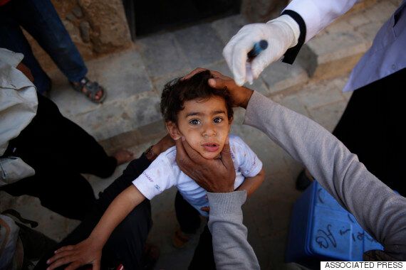 어린이의 눈으로 본 예멘 전쟁: 엄마가 내 앞에서 불타는 걸 봤어요