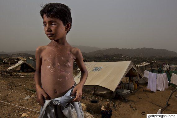 어린이의 눈으로 본 예멘 전쟁: 엄마가 내 앞에서 불타는 걸 봤어요