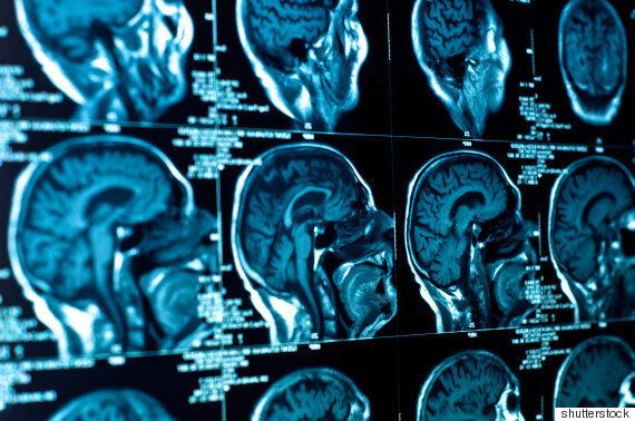 2015년에 과학이 인간의 뇌와 마음에 대해 밝혀낸 놀라운 사실 8가지