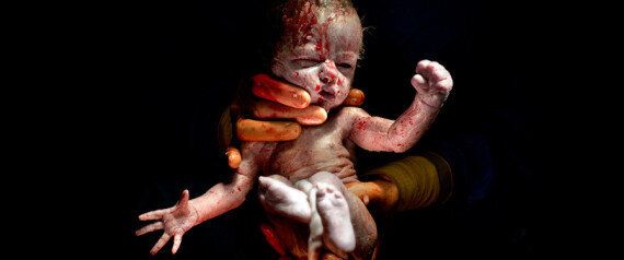 이 아기는 주머니에 담긴 채 태어났다(동영상)