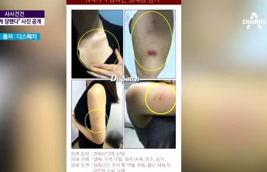 이진욱이 성폭행 누명에서 벗어난 이유 '주저흔'?