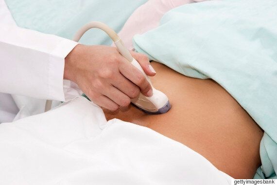 임신 초기 초음파검사가 '심한 자폐증'에 영향을 줄 수도 있다는 연구가 나왔다