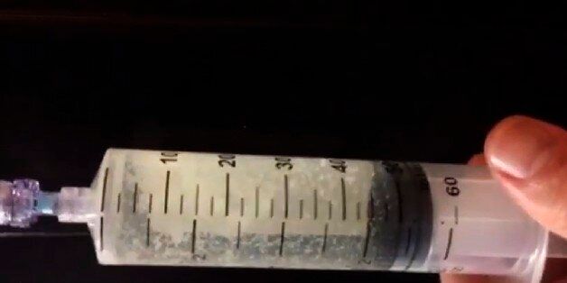 In this undated image made from video and released by the Georgia Department of Corrections,  shows white chunks that had formed in the lethal injection drug the state intended to use for the execution of Kelly Gissendaner, which was scheduled for March 2, 2015. The solution is supposed to be clear and when corrections officials realized the compounded pentobarbital had precipitated, they stopped the execution and temporarily suspended all executions in the state until they could investigate what went wrong with the drug.(Georgia Department of Corrections via AP)