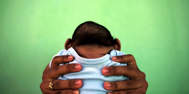 소두증을 앓고 있는 브라질의 한 아기의 지난 2월 모습.
