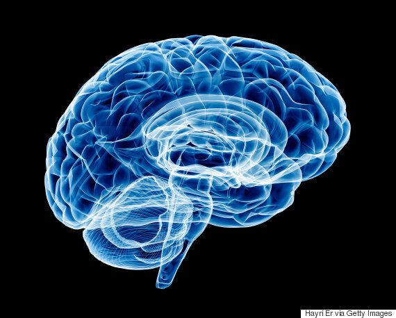 혁신을 원하지 않는 뇌도 발전할 가능성이 있다