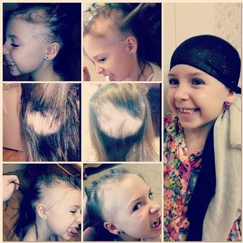 탈모증에 걸린 7세 소녀가 가장 사랑스러운 헤어스타일을 선보였다