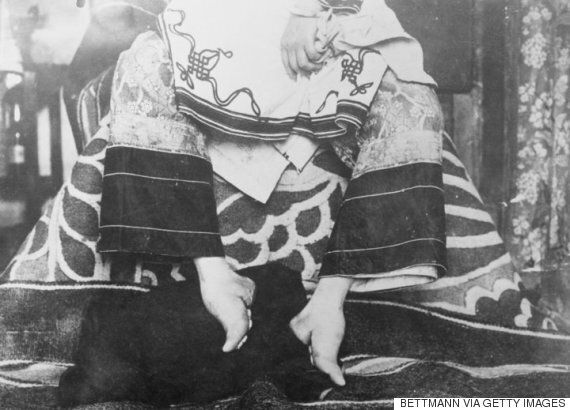 중국 여성이 전족을 감수한 또 하나의 이유가 제시됐다