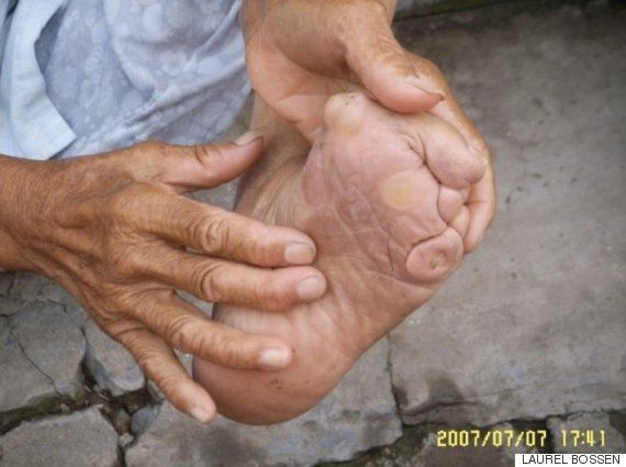 중국 여성이 전족을 감수한 또 하나의 이유가 제시됐다