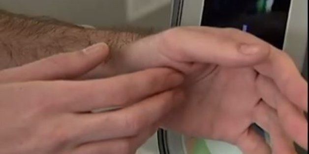 이 남자는 교통카드 칩을 피부에 심었다 (영상)