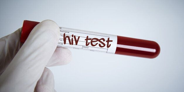 Laboratory Request, Hiv test