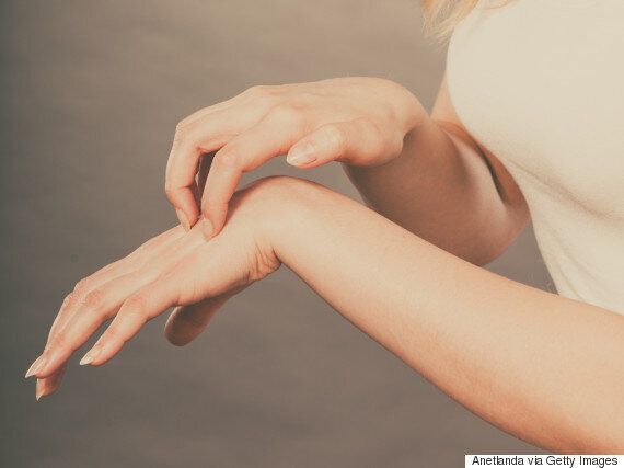 어른이 되고 나서도 ‘아토피'를 겪는 사람의 절실한 고백