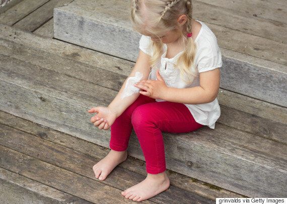 어른이 되고 나서도 ‘아토피'를 겪는 사람의 절실한 고백
