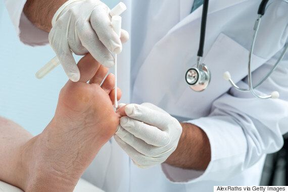 어른이 되고 나서도 ‘아토피'를 겪는 사람의 절실한 고백