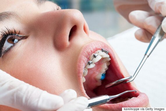 복통을 호소한 환자의 장기에서 10년 전 사라진 물건이 나왔다