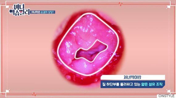 '처녀막' 아닌 '질막'이라 불러야 하는 이유