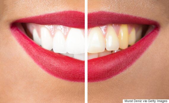 ‘치아 나이'를 달라 보이게 만드는 구강청결제의 주성분