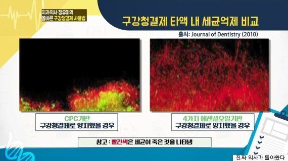 ‘치아 나이'를 달라 보이게 만드는 구강청결제의 주성분