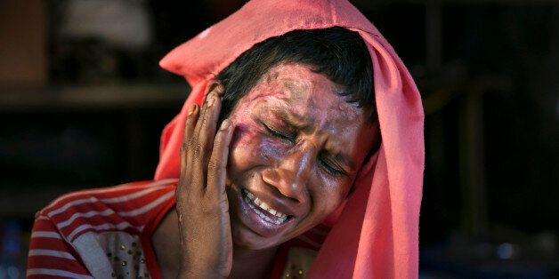 COX'S BAZAR, BANGLADESH - DECEMBER 02: Mumtaz Begum, 30, becomes emotional as she touches the wounds she received when the military set her house on fire after raping her, on December 2, 2017 in Cox's Bazar, Bangladesh. She fled to Bangladesh shortly after the August 25th attack from Tula Toli village in Myanmar. She fled to Bangladesh shortly after the August 25th attack. She says that one night the military attacked her village and burned homes. Everyone ran and hid but the military found them