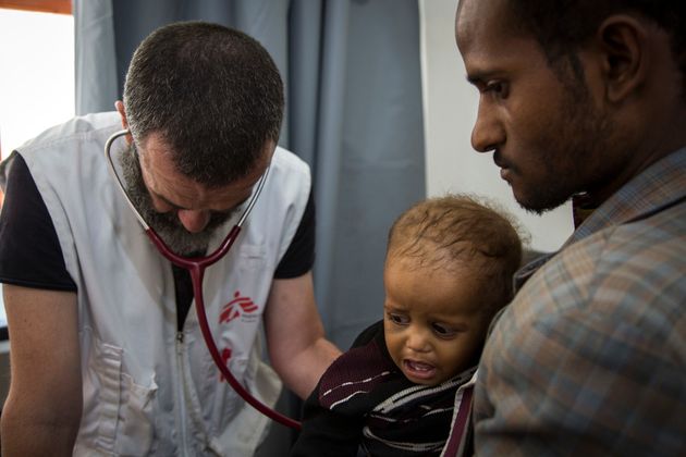 예멘 하이단의 국경없는의사회 병원에서 폐렴 및 영양실조 환자를 치료하고 있는 국경없는의사회 의사