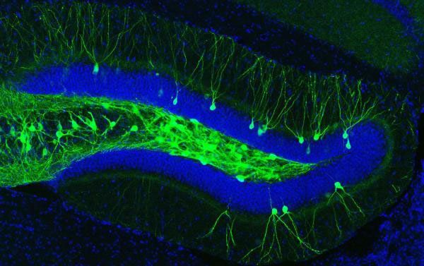 기억의 처리 기능을 하는 해마 치아이랑 부위의 영상. 빛에 민감하게 반응하는 단백질(채널로돕신)이 발현된 기억 세포들이 녹색으로 나타나 있다. 알츠하이머 질환모델 쥐의 뇌 영상.