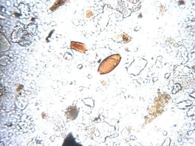 화지산의 변소터 유적의 바닥층을 분석한 결과 검출된 백제시대 편충알들. 1500년전의 기생충 흔적이다. 