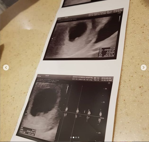 결혼 4년차 방송인 박슬기가 임신 소식을 전했다