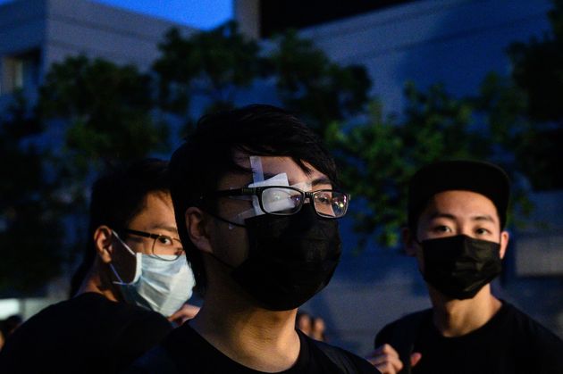 TOPSHOT - A student covers his right eye, after a woman suffered an eye injury which demonstrators blamed on a bean-bag round fired by Hong Kong police at a previous protest, during a school boycott rally at the Chinese University of Hong Kong on September 2, 2019, in the latest opposition to a planned extradition law that has since morphed into a wider call for democratic rights in the semi-autonomous city. - The global financial hub is in the grip of an unprecedented crisis as a largely leaderless movement has drawn millions on to the streets to protest against what they see as an erosion of freedoms and increasing interference in their affairs by Beijing. (Photo by Philip FONG / AFP)        (Photo credit should read PHILIP FONG/AFP/Getty Images)