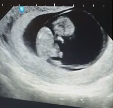 장성규가 아내의 임신 소식을 깜짝 고백했다