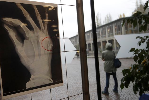 An x-ray of a woman's broken hand bone is displayed during the exhibition 'Invisibility is not a super power' which includes x-ray's of anonymous women who arrived at the hospital's emergency room claiming to be victims of violence, at the San Carlo Hospital, in Milan, Italy, Friday, Nov. 22, 2019. The exhibition, a combination of photographs and x-rays, was promoted on the occasion of the International day for the Elimination of Violence Against Women which takes place on Nov. 25.  (AP Photo/Luca Bruno)