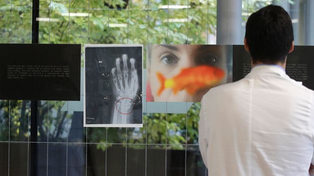 A doctor looks at a a photograph and an x-ray of a woman's broken wrist displayed during the exhibition 'Invisibility is not a super power' which includes x-ray's of anonymous women who arrived at the hospital's emergency room claiming to be victims of violence, at the San Carlo Hospital, in Milan, Italy, Friday, Nov. 22, 2019. The exhibition, a combination of photographs and x-rays, was promoted on the occasion of the International day for the Elimination of Violence Against Women which takes place on Nov. 25.  (AP Photo/Luca Bruno)