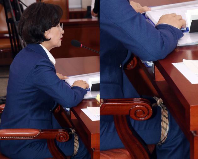 추미애 법무부장관후보자가 30일 서울 여의도 국회에서 열린 인사청문회에서 다리를 손수건으로 묶고 청문회에 임하고 있다