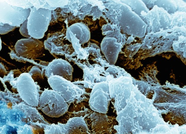 (자료사진) 흑사병을 일으키는 페스트균의 현미경 확대 사진.