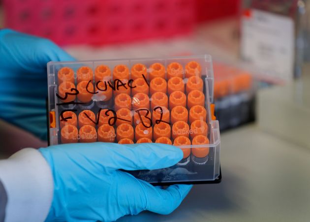 (자료사진) 영국 런던 임페리얼컬리지의 연구소에서 한 연구진이 코로나19 백신 임상시험 참여자들의 혈액 샘플을 들어보이고 있다. 2020년 7월30일.
