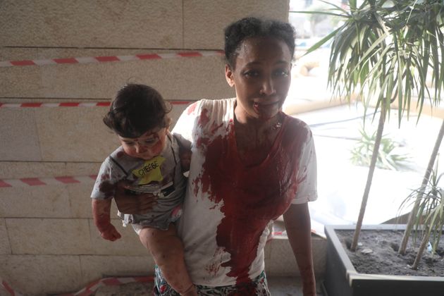 폭발로 상처를 입은 한 여성이 아기를 안고 있다. 