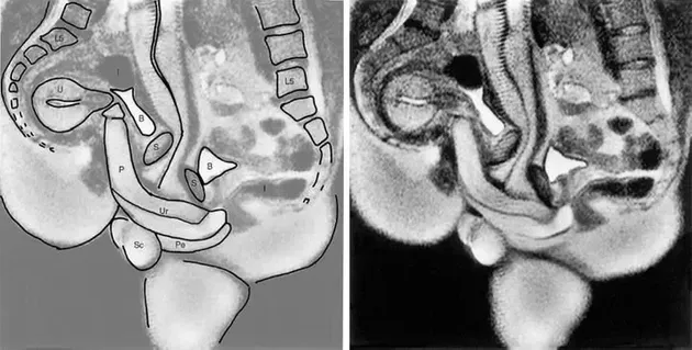 삽입섹스하는 과정을 찍은 MRI(자기공명영상) 촬영본. P는 페니스, Ur은 요도, Pe는 회음, U는 자궁, B는 방광, I는 장, L5는 요추, Sc는 음낭이다.