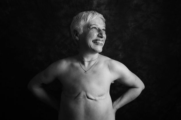 잉글랜드 하트퍼드셔에서 온 줄리엣 피츠패트릭(57세)은 2016년 왼쪽 가슴에 유방암 진단을 받았다.