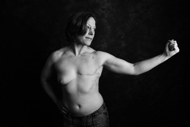 포츠머스에서 온 토마시나 맥기건(45세)은 20세 때 3기 침습성 유방암 진단을 받았다.