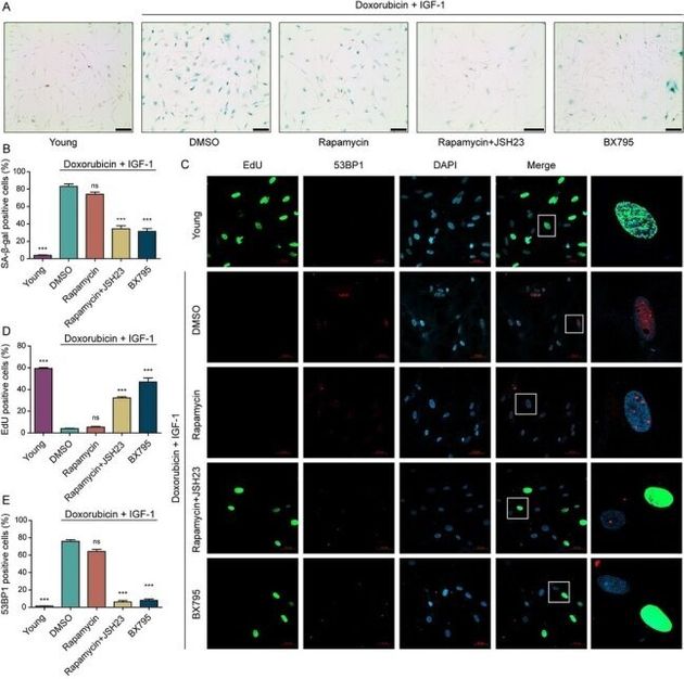 카이스트 조광현 교수 연구팀은 피디케이1의 발현을 억제한 뒤 노화된 인간 진피 섬유아세포의 세포노화 표지 인자들을 확인해 '회춘 효과'를 입증했다.