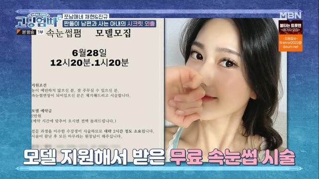 속눈썹 시술도 한다. 물론 공짜로!