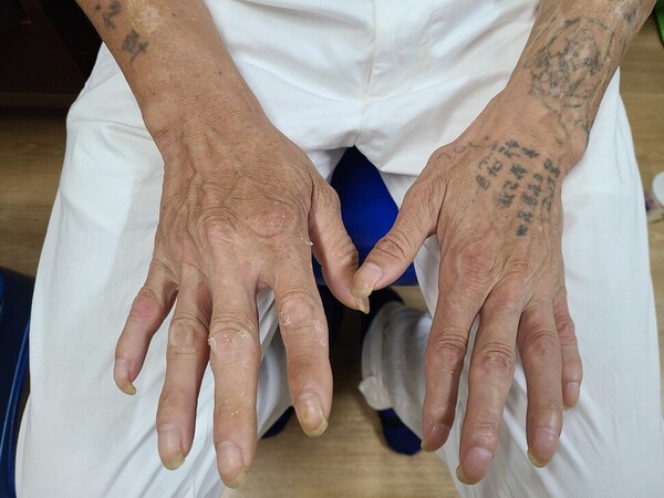 문신이 새겨진 김석진(가명·58)씨의 손.