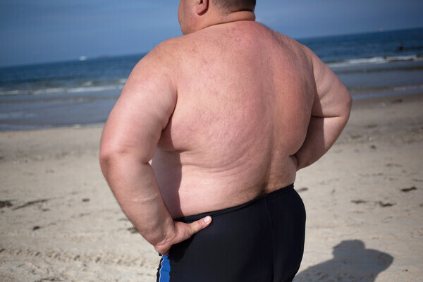 PRODUCTION - 04 September 2021, Poland, Swinemünde: An overweight man stands on the beach. Photo: Fernando Gutierrez-Juarez/dpa-Zentralbild/ZB (Photo by Fernando Gutierrez-Juarez/picture alliance via Getty Images)