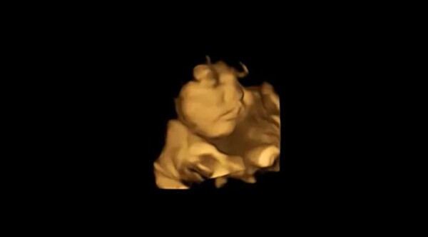 자궁 속에서 중립적인 표정을 짓고 있는 아기 / 출처 : FETAP (FETAL TASTE PREFERENCES) STUDYPA