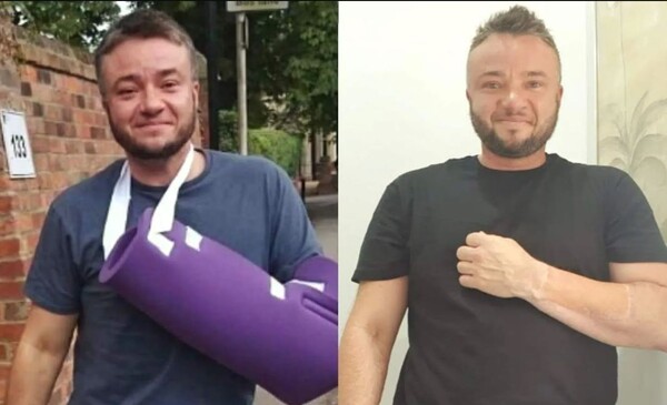 음경형성술 후 흉터를 당당히 공개한 핀레이 게임스 ⓒFInlay Games