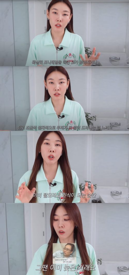 탈모에 대해 이야기하는 한혜진.&nbsp;ⓒ유튜브 채널 '한혜진'