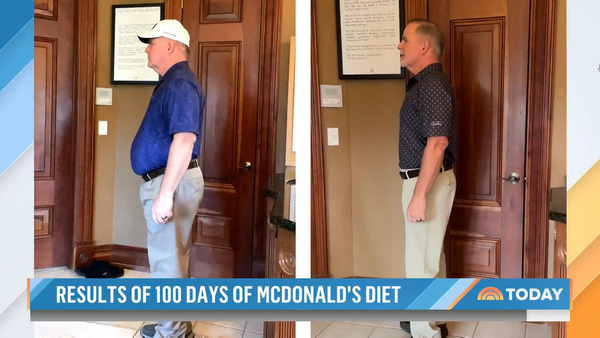 100일 동안 맥도날드 먹기 챌린지의 결과. ⓒNBC뉴스 'Today'